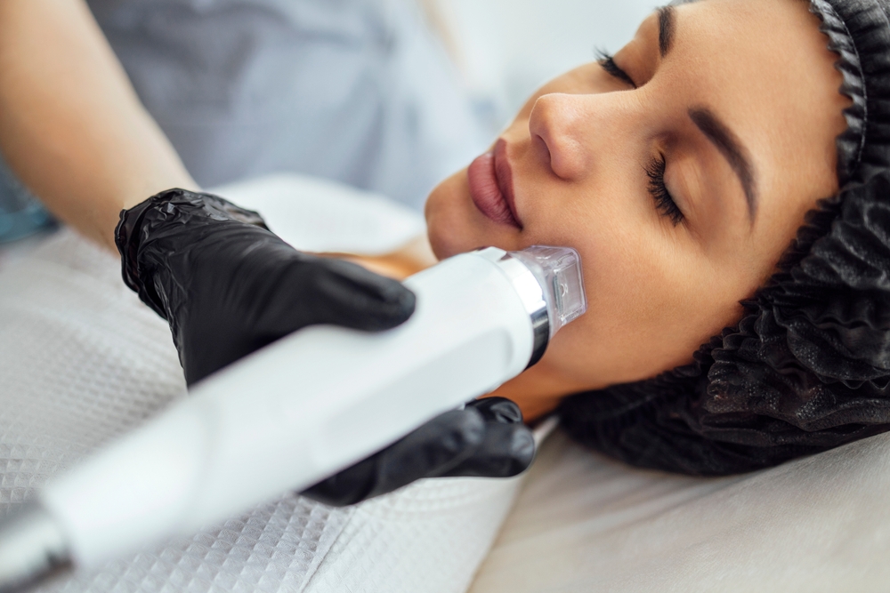 Microneedling