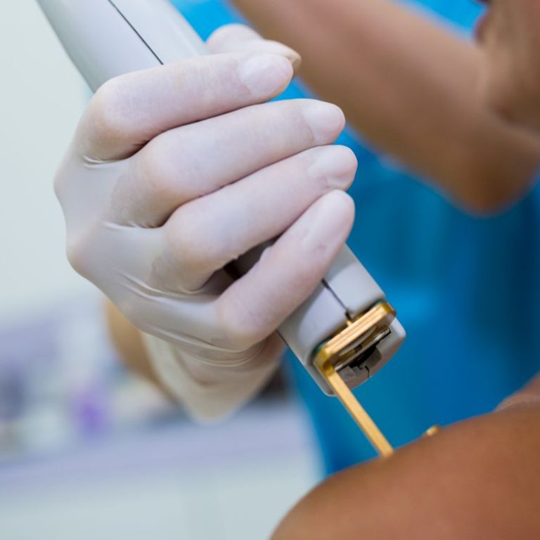Woman receiving laser epilation treatment on her shoulder at beauty salon